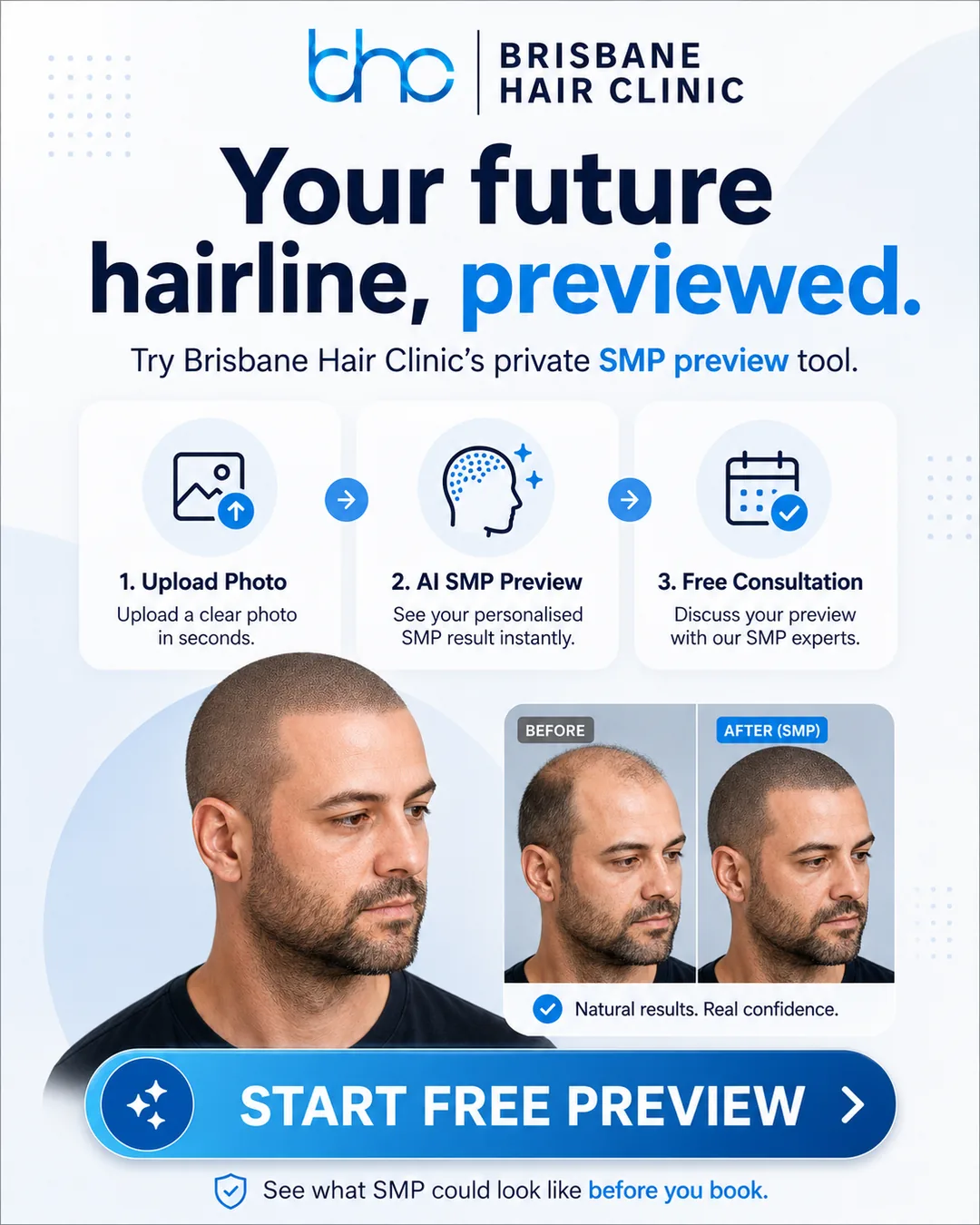 Brisbane Hair Clinic ad by Scaled promoting an AI hairline preview tool